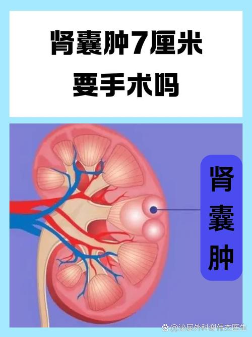 发现肾囊肿,哪些情况需要手术?
