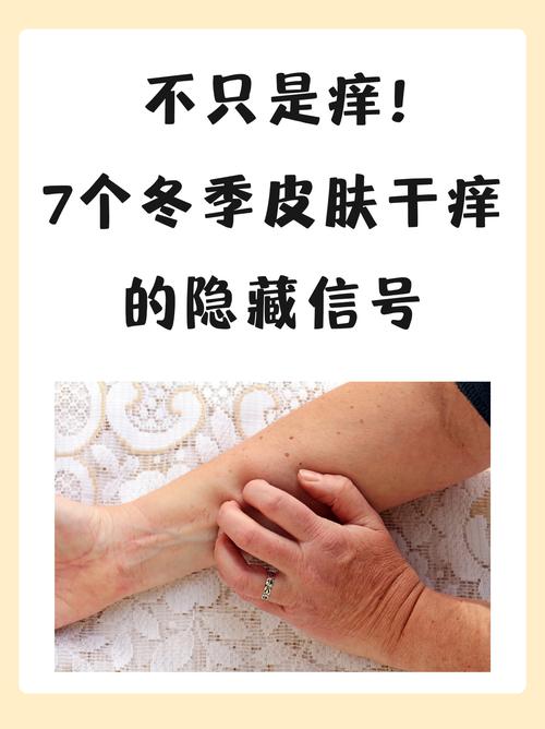 冬天皮肤痒别不当回事，当心是这种问题找上门，中老年人尤其注意！